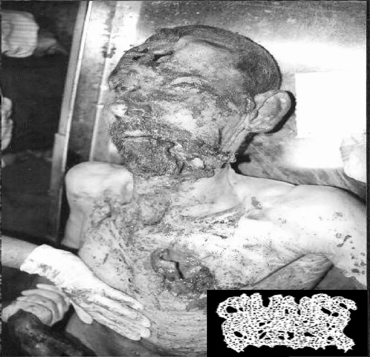 Clumps of Flesh - Corpse Mutilation Album Cover