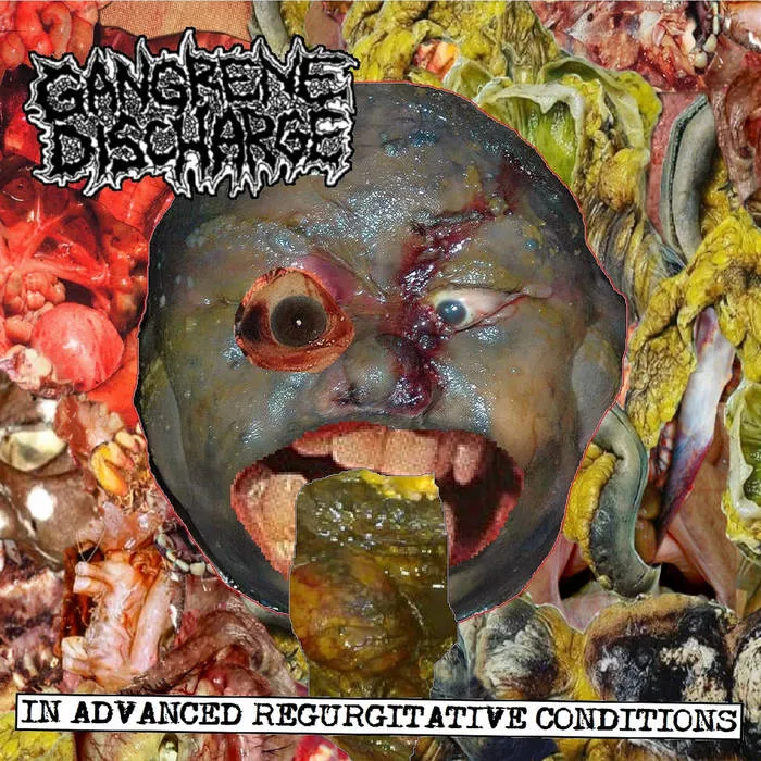 In Advanced Regurgitative Conditions
