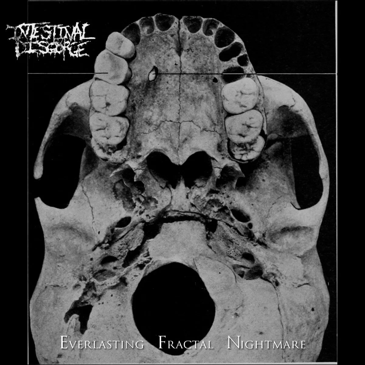 Intestinal Disgorge - Everlasting Fractal Nightmare Album Cover